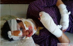 La foto pubblicata da Gazzetta della Sera per l'articolo bufala: è una ragazzina vittima di violenza